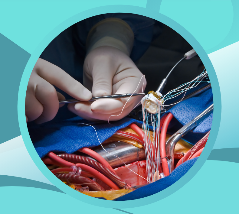 Expert Aortic & Carotid Care